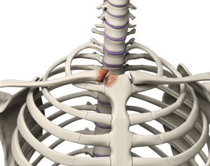 STERNOCLAVICULAR ARTHRITIS